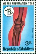 Colnect-4556-800-Rheumatic-knee.jpg